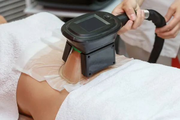 Image of person having fat freezing treatment to help weight gain Leicestershire