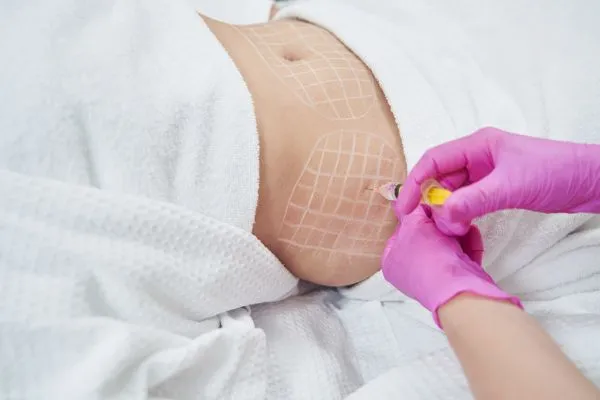 image of fat dissolving injections on love handles to help combat weight gain Leicestershire