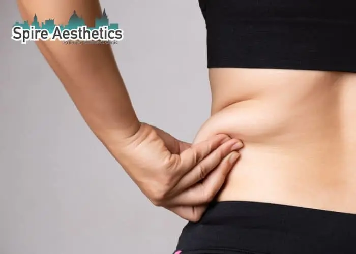 Image of woman pinching fat on their hips Leicestershire. Fat Freezing treatment