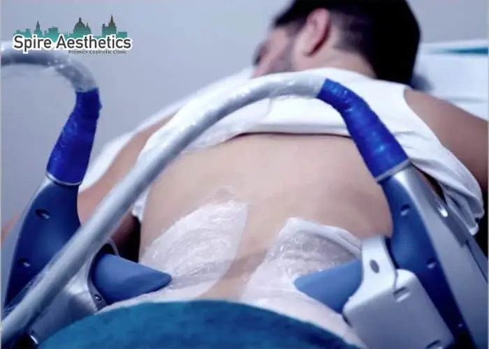 Man having fat freezing treatment done on love handles before a competitions Leicestershire to create a sculpted look.