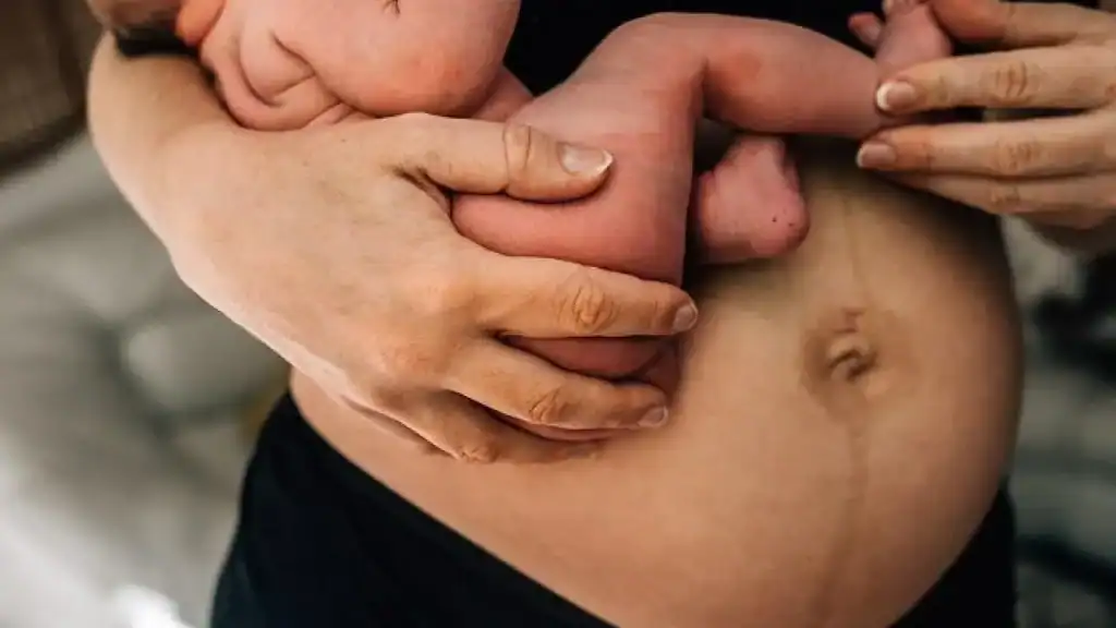 Why Is My Stomach Still Big After Pregnancy Leicestershire?